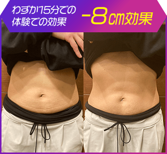 ボディ施術例01