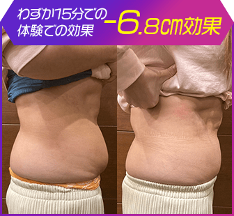 ボディ施術例03