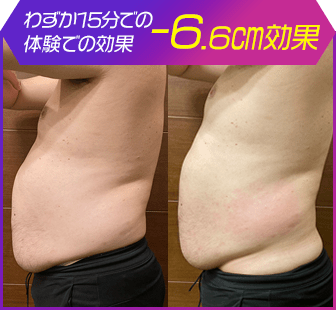 ボディ施術例04