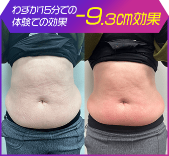 ボディ施術例06