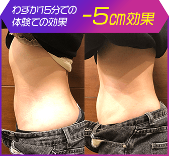 ボディ施術例10