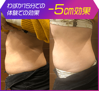 ボディ施術例11