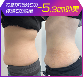 ボディ施術例17