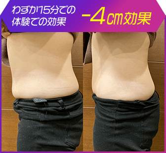 ボディ施術例18