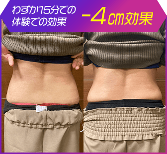 ボディ施術例19