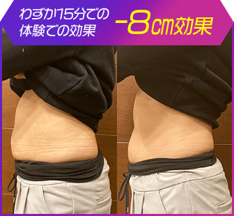 ボディ施術例22